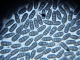 Macrodiplodiopsis desmazieri image