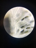 Rosellinia corticium image