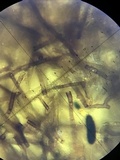 Rosellinia corticium image