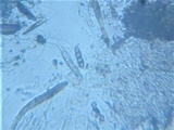 Byssosphaeria schiedermayeriana image