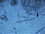 Byssosphaeria schiedermayeriana image