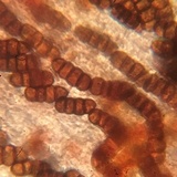Rhytidhysteron rufulum image