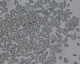 Parascedosporium putredinis image