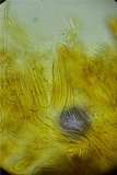 Rhytisma americanum image