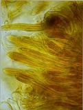 Rhytisma americanum image