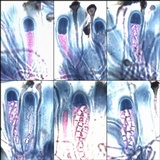 Toninia aromatica image
