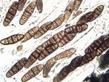 Oedohysterium pulchrum image