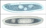 Pertusaria pertusa image