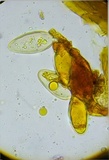 Ochrolechia africana image