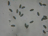 Jackrogersella multiformis image