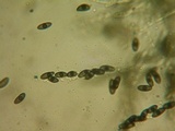 Jackrogersella multiformis image
