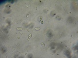 Mycena metata image