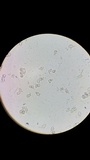 Nolanea cetrata f. minimospora image