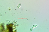 Gyalolechia flavorubescens image