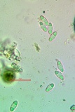 Gyalolechia flavorubescens image