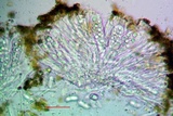 Candelariella antennaria image