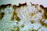 Candelariella antennaria image