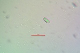 Candelariella antennaria image
