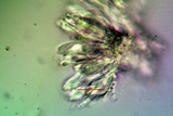 Candelariella antennaria image
