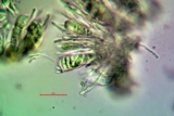 Candelariella antennaria image