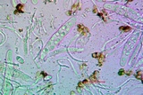 Caloplaca flavorubescens image