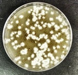 Image of Cryptococcus gattii
