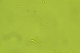 Repetobasidium macrosporum image