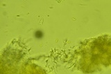 Repetobasidium macrosporum image