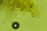 Repetobasidium macrosporum image