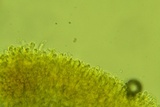Repetobasidium macrosporum image