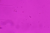 Repetobasidium macrosporum image