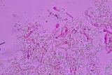 Repetobasidium macrosporum image