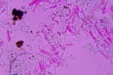 Repetobasidium macrosporum image