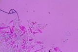 Repetobasidium macrosporum image