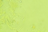 Dacryobolus sudans image