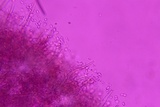Amphinema byssoides image