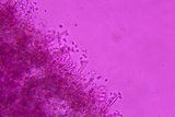 Amphinema byssoides image