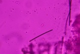 Tulasnella violea image