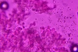 Tulasnella violea image