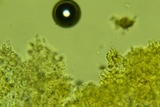 Sistotremastrum suecicum image