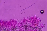 Sistotremastrum suecicum image
