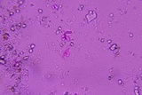 Sistotremastrum suecicum image