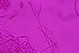 Fibulomyces mutabilis image