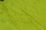 Podoscypha thozetii image