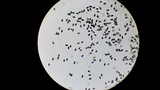 Psathyrella prona image