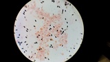 Psathyrella prona image