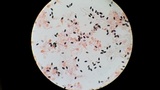Psathyrella prona image