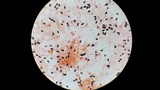 Psathyrella prona image