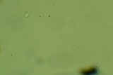 Lophodermium schweinitzii image