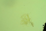 Lophodermium schweinitzii image